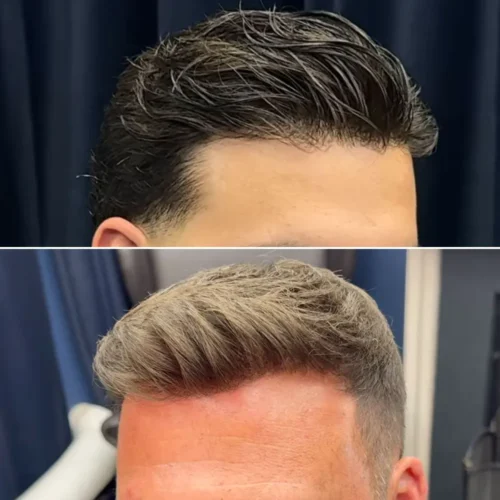 Invisible knotless front hairline on getmehair 0.08mm thin skin v loop toupee