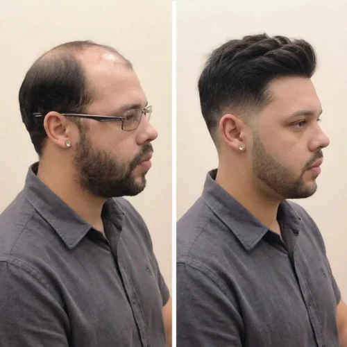 Model wearing 90 percent density getmehair full swiss lace toupee