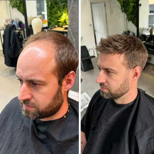 0.04-0.06mm transparent poly base of the getmehair thin skin mens hair system